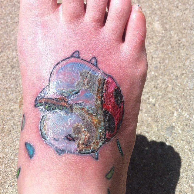 Picture of an infected tattoo on a right foot. 
